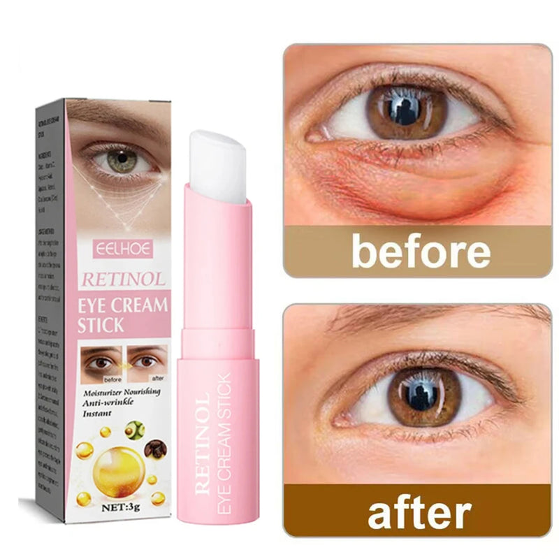 Retinol - Creme para os olhos remoção instantânea de rugas olheiras hidratante